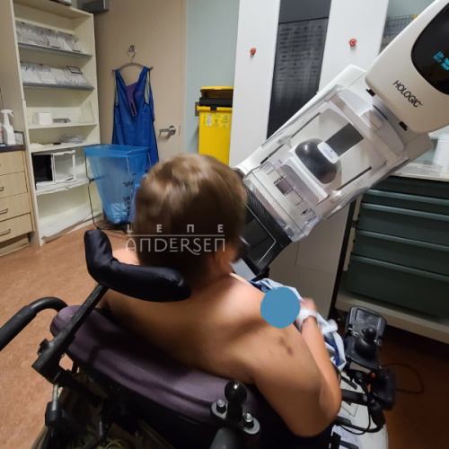 a woman with short hair and in a wheelchair is seen from the back. She has no shirt on. In front of her is a mammogram machine